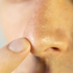 mann med kombinert hudtype som holder fingen på nesen