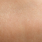 Nærbilde av tørr hudtype