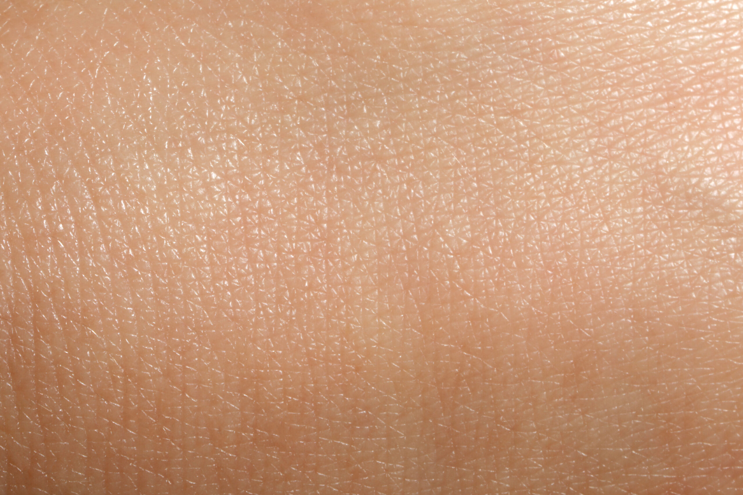Close-up of dry skin type